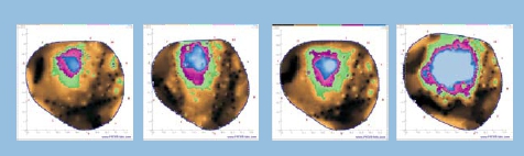 PiCUS-3树木断层检测仪 PiCUS-3树木断层检测仪